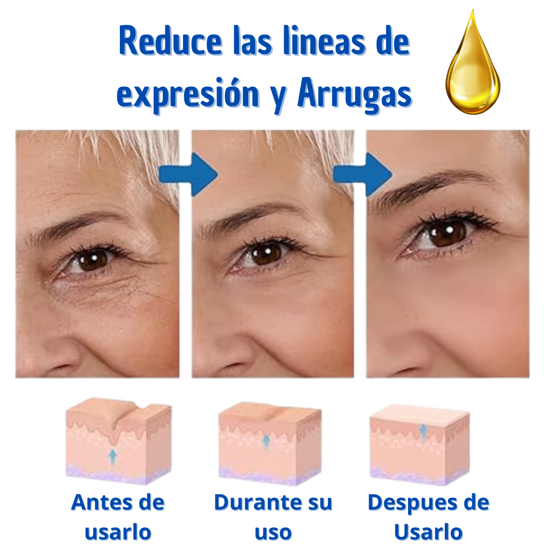 Botox Stock Solution Suero antiarrugas