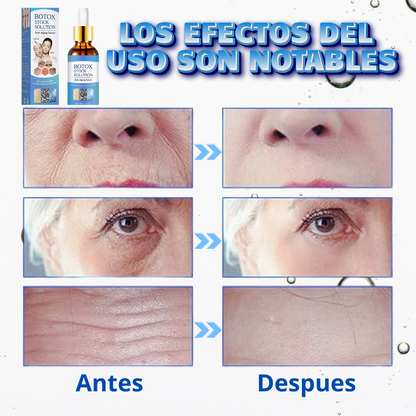 Botox Stock Solution Suero antiarrugas