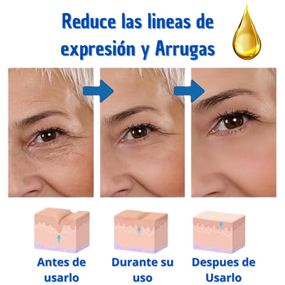 Botox Stock Solution Suero antiarrugas