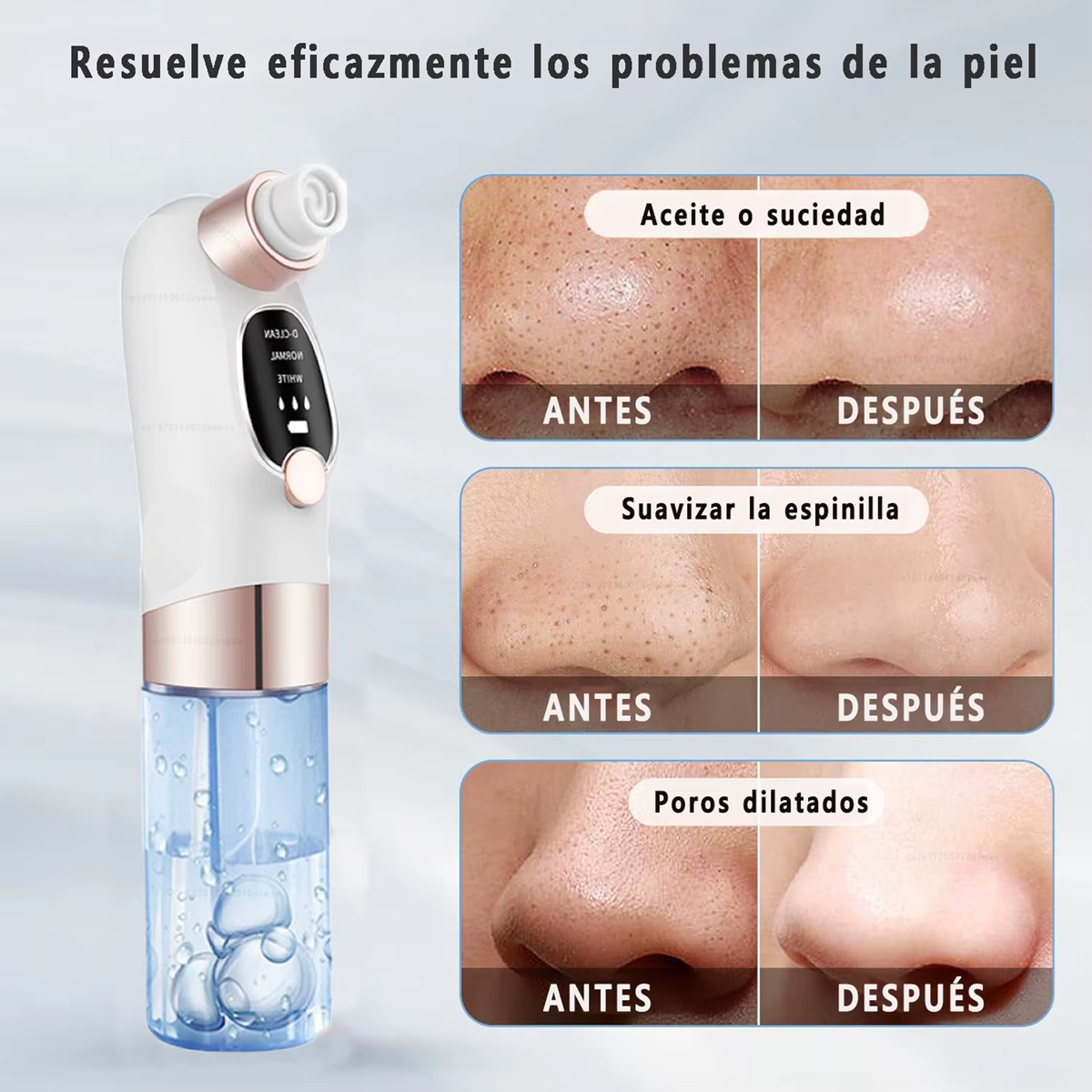 LIMPIADOR FACIAL EXTRACTOR PUNTOS NEGROS
