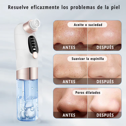 LIMPIADOR FACIAL EXTRACTOR PUNTOS NEGROS